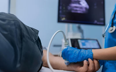 Promoción Cirugía Cardiovascular